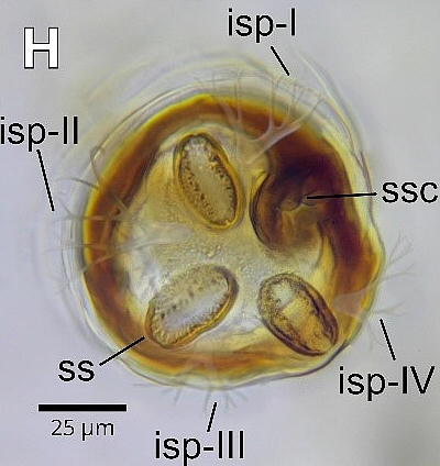 Silba adipata McAlpine larva: posterior spiracle details.