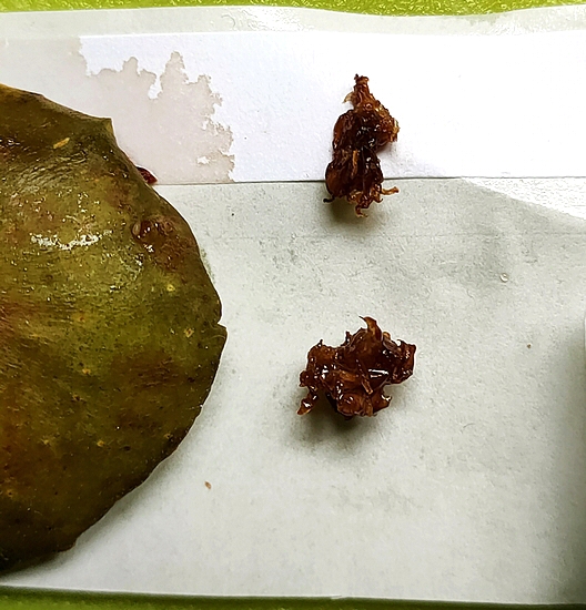 Two brownish masses to be identified, extracted from the infructescence of the D1 ripe fig.