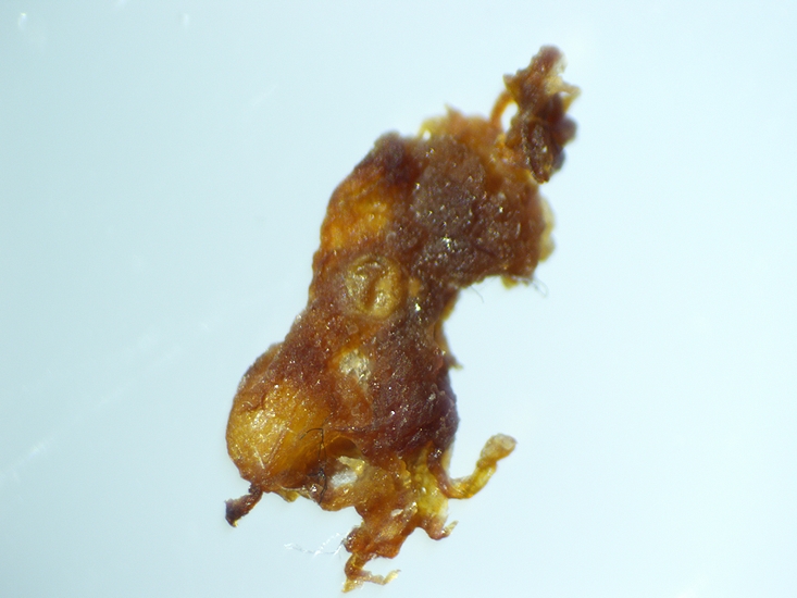 Stereomicroscope examination of a brownish mass with a dry imago appearance, extracted from the infructescence of the D1 fig.