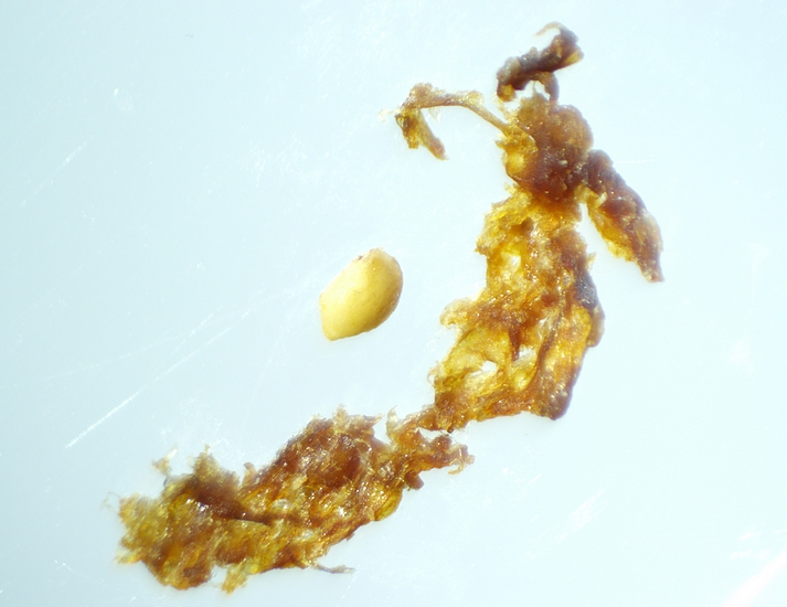 Fragmentation and crushing under stereomicroscope of the brownish mass extracted from the infructescence of the D1 fig.