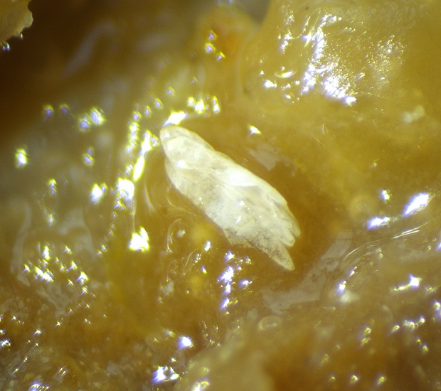 Three Silba adipata McAlpine chorions found under an ostiolar scale of 'Dalmatia' ripe fig no. 4.